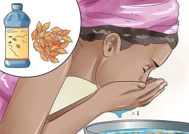 11 روش درمان گل مژه (چگونه از شر گل مژه خلاص شویم؟)