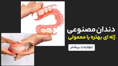 دندان مصنوعی ژله‌ای بهتره است یا معمولی؟ مقایسه کامل و علمی