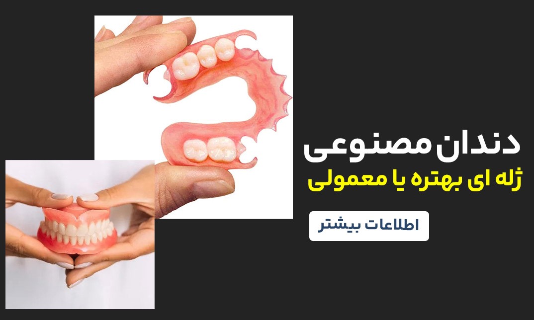 دندان مصنوعی ژله‌ای بهتره است یا معمولی؟ مقایسه کامل و علمی
